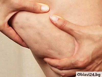 Премахване на целулита с антицелулитен масаж - obiavi24.bg